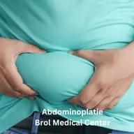 Beneficiile estetice ale abdominoplastiei