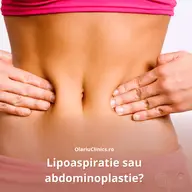 Liposuctie sau abdominoplastie?