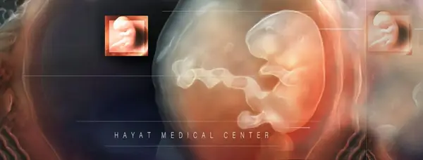 Hayat Medical Center