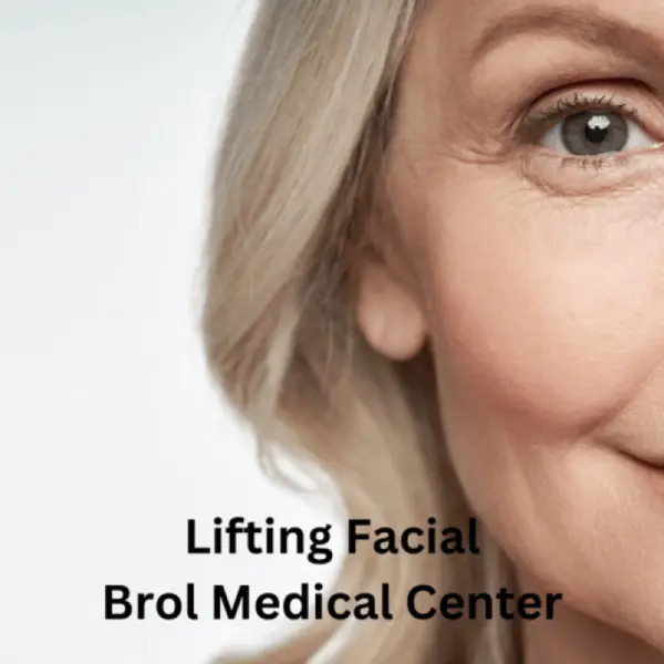 Liftingul facial chirurgical