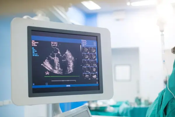 Ce este și când se recomandă ecografia cardiacă?