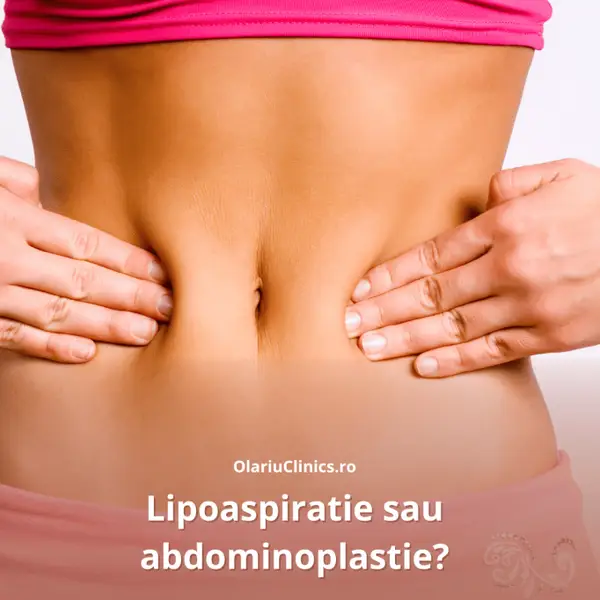 Liposuctie sau abdominoplastie?