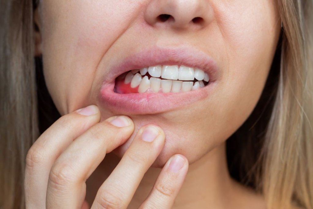 Ai un dinte ciobit, rupt sau crăpat? Iată ce trebuie să știi